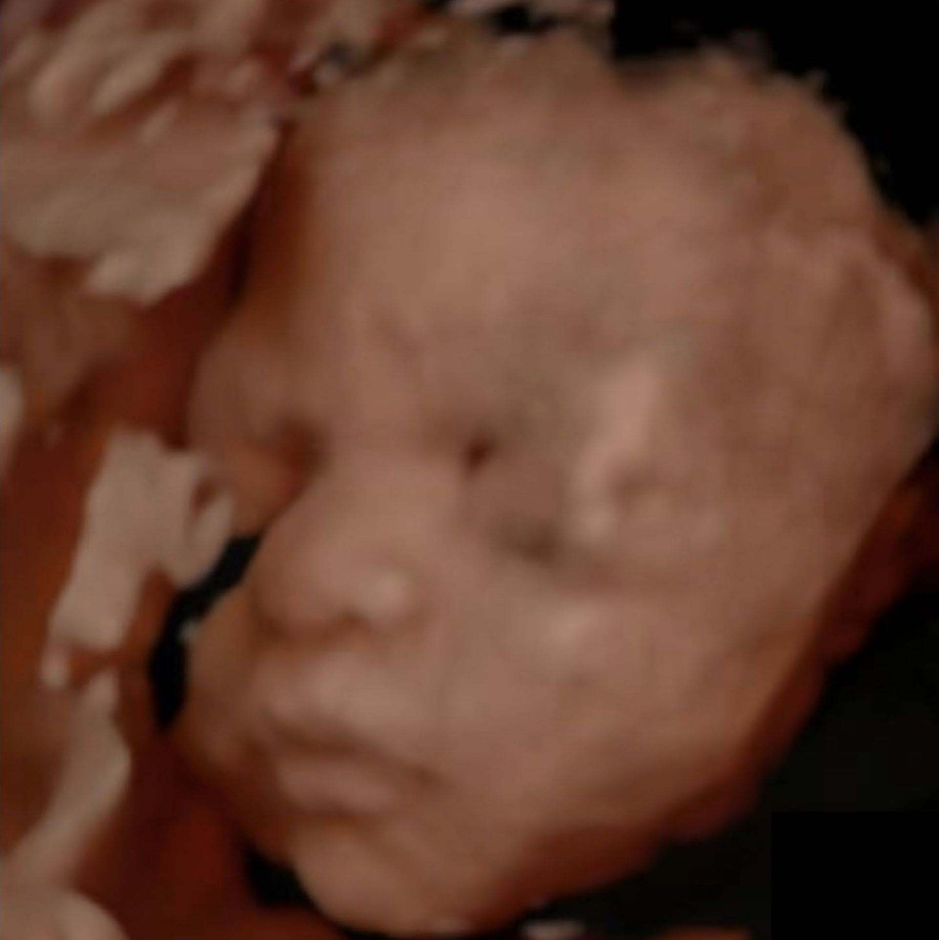 3D ultrasound input