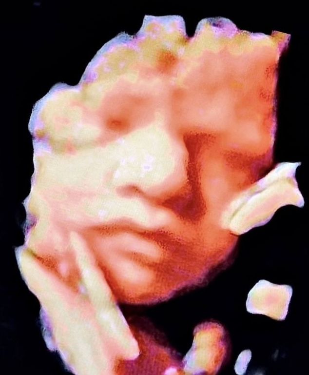 3D ultrasound input