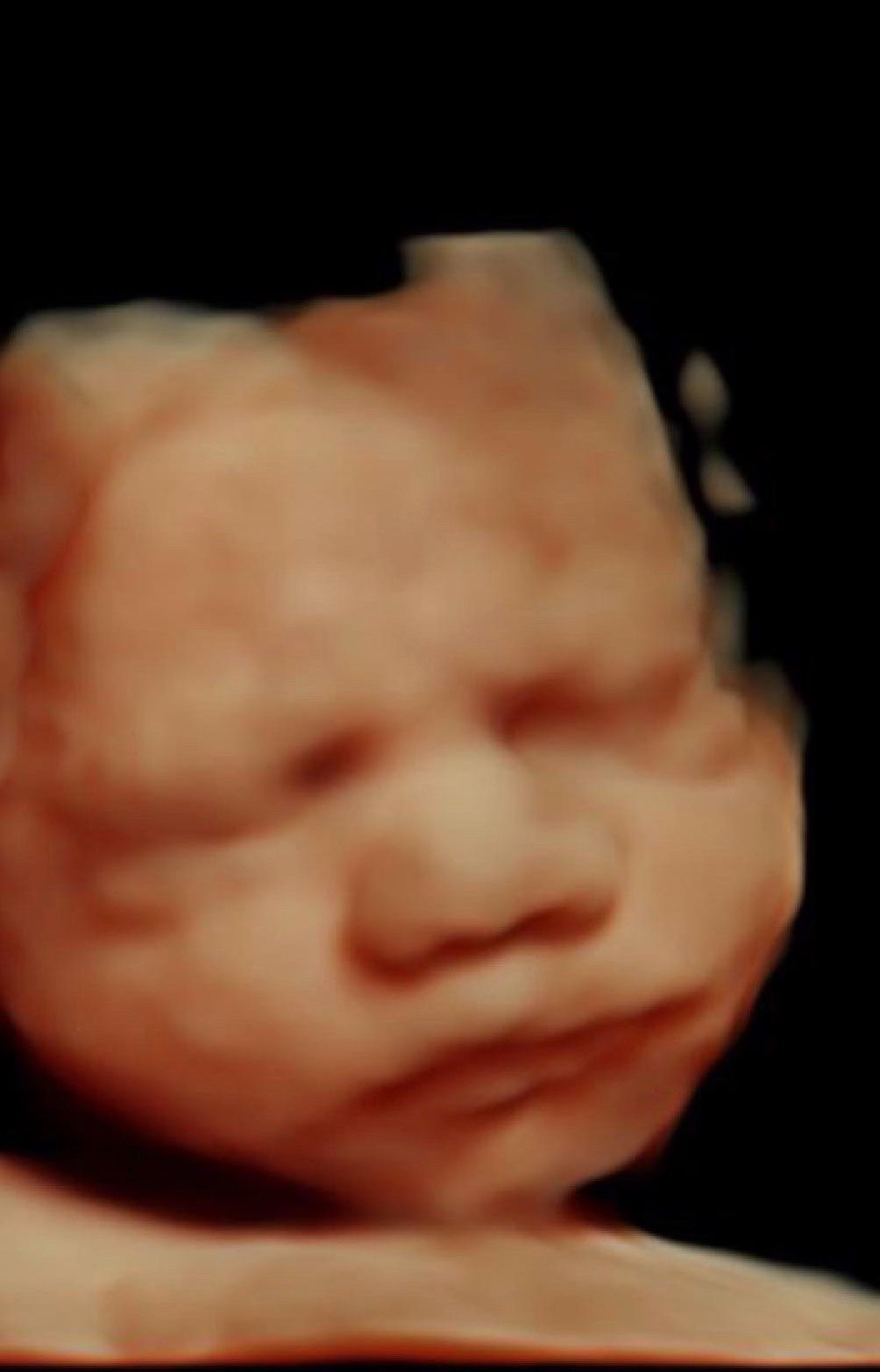 3D ultrasound input