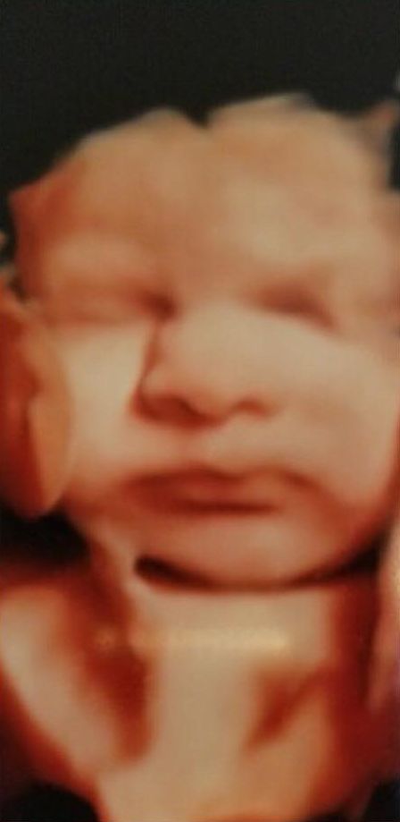 3D ultrasound input